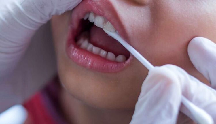 استرس-بر-دهان-و-دندان-چه-تاثیری-دارد؟