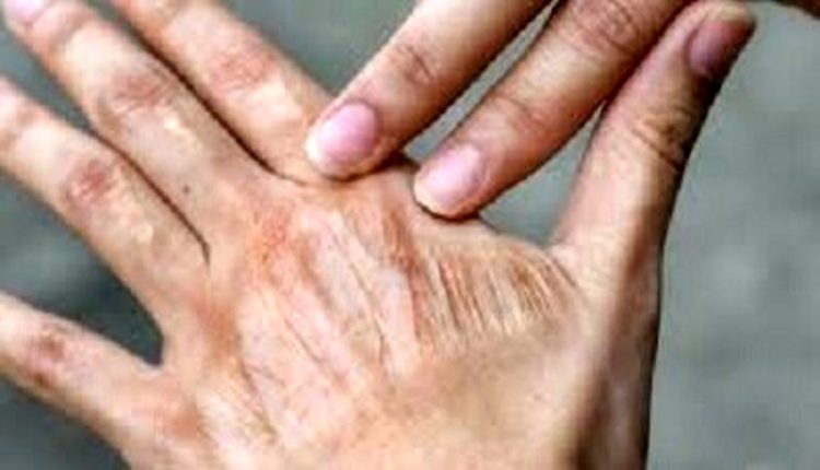 اشتباه-های-رایج-در-مراقبت-روزانه-از-پوست.jpg